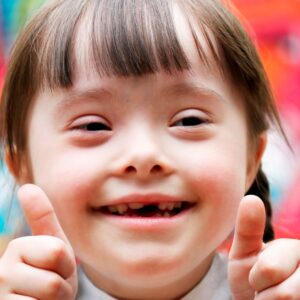 Interesting Facts About Down Syndrome: Awareness Facts & Humanity