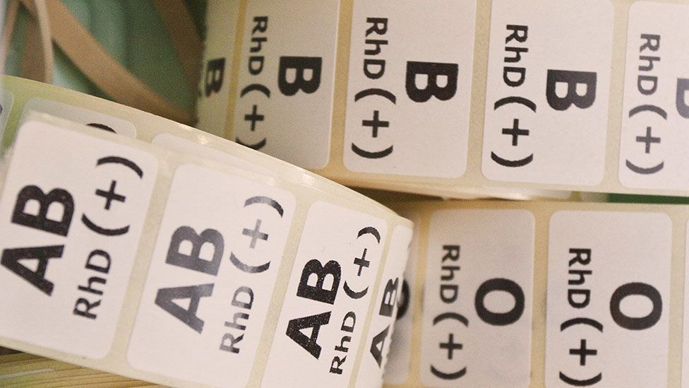 Facts About Blood Type A Negative You Might Not Know